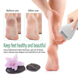 Electronic Foot File, Portable Callus Remover Pedicure - Silk Rolla